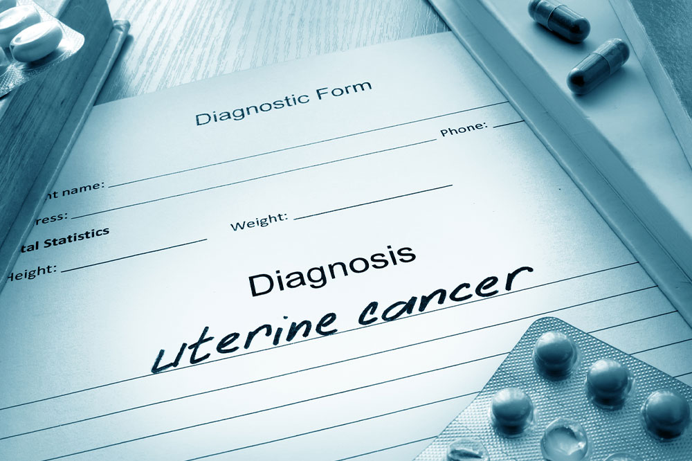Uterine cancer – Causes, symptoms, and management