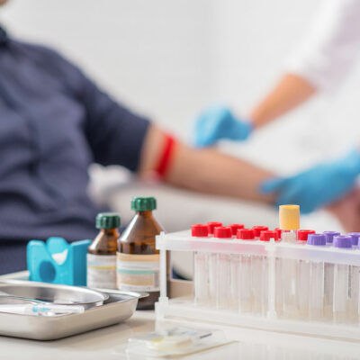 Chronic immune thrombocytopenia – Symptoms and management